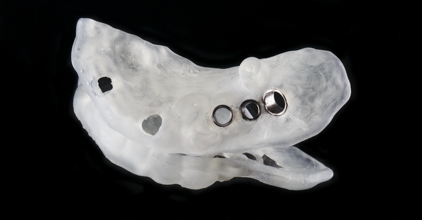 dr lesnik alexandre - implant dentaire montpellier