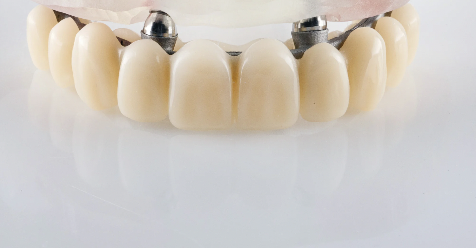 dr lesnik alexandre - implant dentaire montpellier